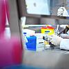 Eine Frau zeigt in einem Labor des Landesgesundheitsamtes einen Test für das neue Virus 2019-nCov.