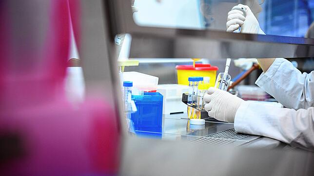 Eine Frau zeigt in einem Labor des Landesgesundheitsamtes einen Test für das neue Virus 2019-nCov.
