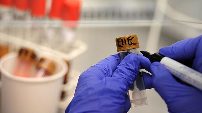 Die Zahl der Ehec-Infektionen ist in Baden-Württemberg gestiegen.(Archiv)