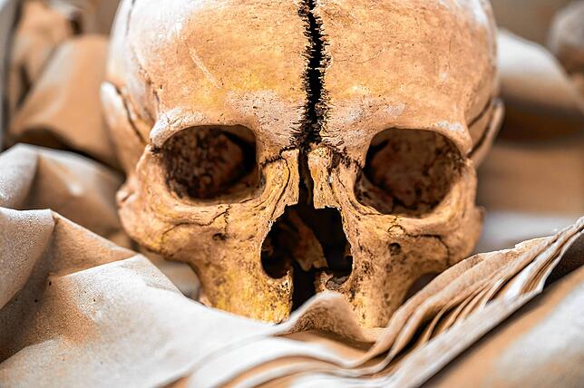 Schädelkalotte eines Hingerichteten, die die Archäologen bei Allensbach bergen konnten.