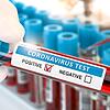 Coronavirus 2019 nCoV positive blood test. Blood sample in lhand of doctor in laboratory. 3d illustration