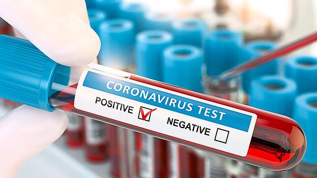 Coronavirus 2019 nCoV positive blood test. Blood sample in lhand of doctor in laboratory. 3d illustration