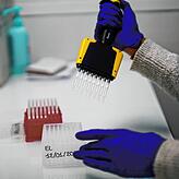 Die Untersuchung des Coronavirus auf Mutationen (Sequenzierung) – hier eine Aufnahme aus dem zuständigen Fachinstitut des ...