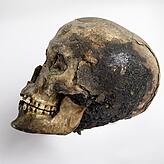 Fast 3000 Jahre alt ist der ägyptische Mumienschädel, den der Überlinger Abenteurer Franz Mader vor über 300 Jahren aus Ägypten ...
