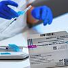 Der AstraZeneca Impfstoff ist im Schwarzwald-Baar-Kreis öfters mal übig. Dazu gibt es jetzt eine Liste für kurzfristige Termine. Und es ...