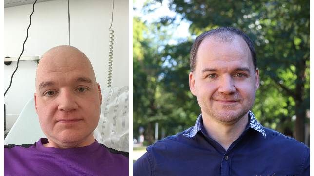 Vorher und nachher: Markus Hilser aus Lauterbach im Landkreis Rottweil im Mai 2020 während seiner Chemotherapie (links). Heute ist er ...