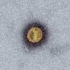Das Coronavirus bestimmt bereits seit Monaten unseren Alltag. &bdquo;Ein Long-Covid-Verlauf ist derzeit nicht meldepflichtig. Es werden ...