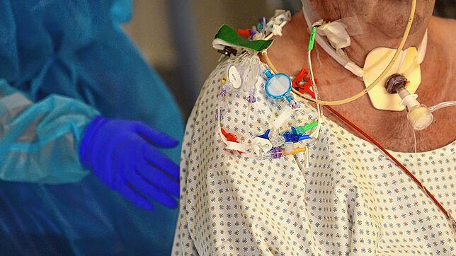 Dieser Patient hat einen Zugang und wird beatmet. Aktuell liegen sechs Menschen auf der Intensivstation des Klinikums Friedrichshafen. ...