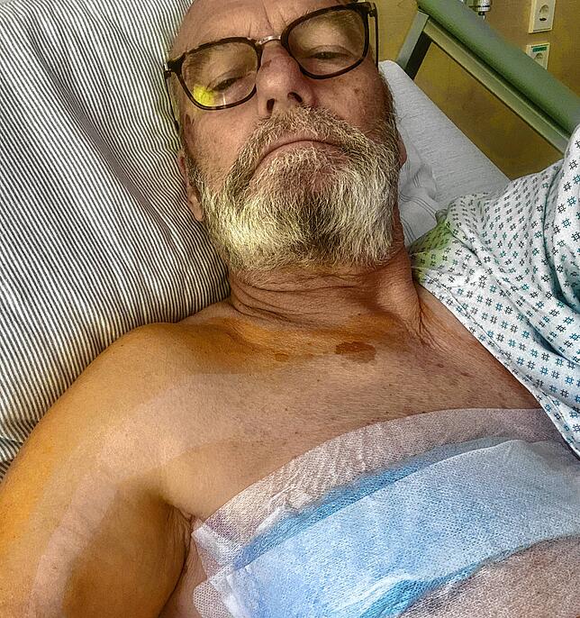 Olaf Michel kurz nach seiner Brustkrebs-Operation, bei dem der Tumor entfernt wurde. Leider kam noch eine Chemotherapie hinterher.