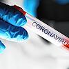 Male chemist hand in blue protective gloves hold test tube closeup background
