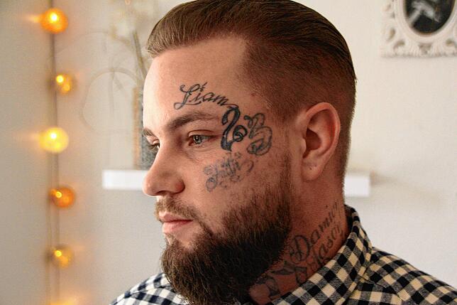 Der Schriftzug Liam soll bleiben, die anderen Tattoos möchte sich Dean entfernen lassen.