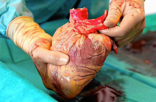 Ein Herz, das für eine Transplantation einem Verstorbenen entnommen wurde.