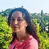 Bouchra überlebte einen Angriff ihres Partners. Sie bleibt gezeichnet fürs Leben – und will sich gerade deswegen zeigen.