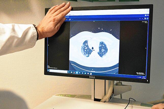 Lungenkrankheit: Covid-19 befällt in den meisten Fällen die Lunge von Betroffenen. Täglich werden Aufnahmen von Patientenlungen im ...
