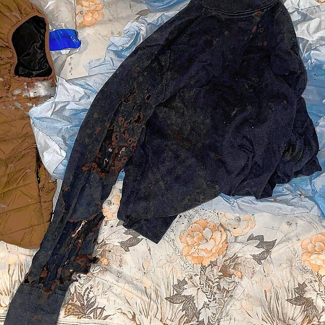 Schellingers Kleidung am Tattag: Obwohl er mehrere Schichten trug, fraß sich die Säure bis auf die Haut durch – bis heute trägt er ...