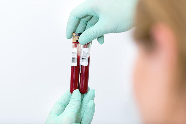 Mit einfachen Bluttests kann während der Schwangerschaft herausgefunden werden, ob das Kind krank ist oder eine Behinderung hat.