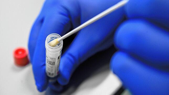 Abstrich für das Testverfahren auf das Virus SARS-CoV-2. (Symbolbild)