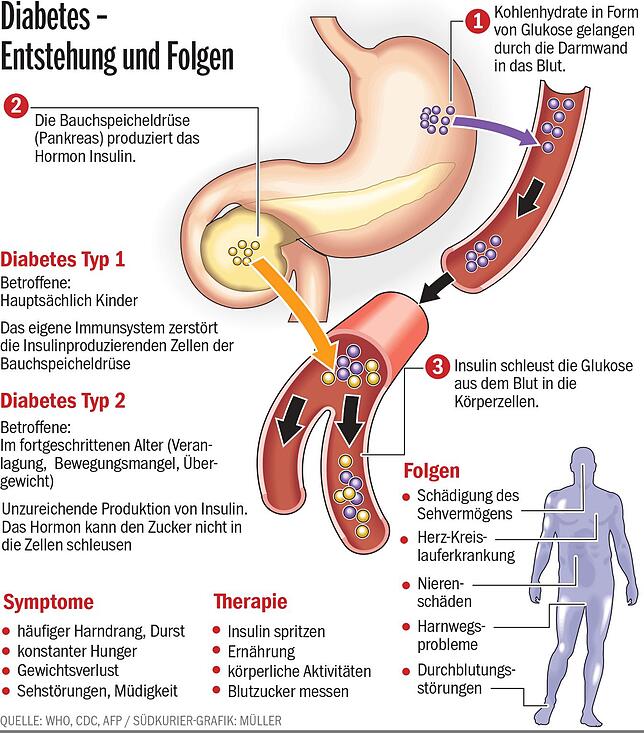 Bild 1: Die umstrittene Diabetes-Vorstufe