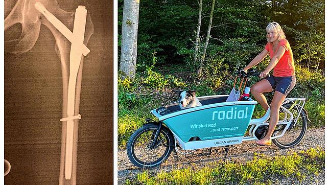 Grit K. auf einem Lastenrad, mit dem sich der Unfall allerdings nicht ereignete. Das Röngtenbild zeigt die Schrauben und Nägel in ihrem ...