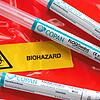 Mehrere Abstrichstäbchen im Plastikröhrchen liegen in der Infektions-Ambulanz (Symbolbild).