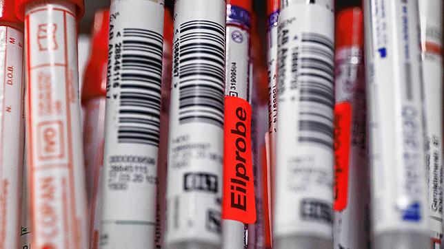 Test auf Covid-19: Die Teststäbchen werden nach dem Rachenabstrich in Teströhrchen verpackt. Ob der Virus beim Patienten nachgewiesen ...