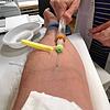 7,5 Milliliter Blut werden für einen Antikörpertest benötigt. In der Gemeinschafts-Hausarztpraxis von Gereon Dennebaum in Villingen ...