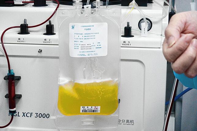 Gespendetes Plasma eines geheilten Coronavirus-Patienten wird in einem Plasmabeutel aufgefangen. Patienten, die sich nach einer ...