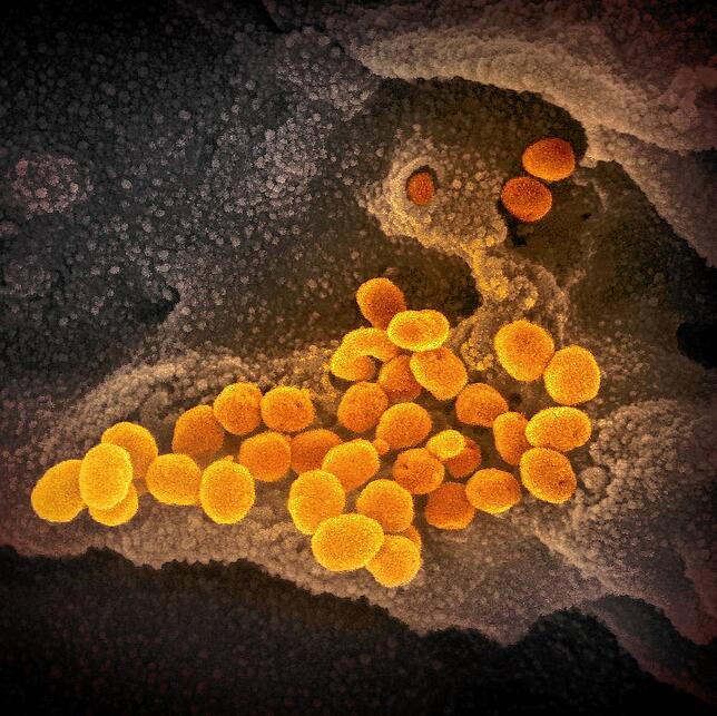 Das Coronavirus unter dem Elektronenmikroskop: Es tritt gerade aus der Oberfläche von im Labor kultivierten Zellen aus.