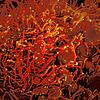 Eine rot gefärbte Zelle ist mit dem Coronavirus infiziert (gelb): Welche Folgen könnte eine zweite Pandemiewelle haben? Antworten ...