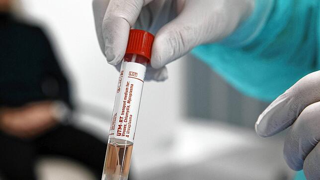 Die Corona-Probe: Auch Ärzte können sich am Virus infizieren. Dies ist dem in Radolfzell tätigen Dermatologen Andras Roszondai passiert. ...