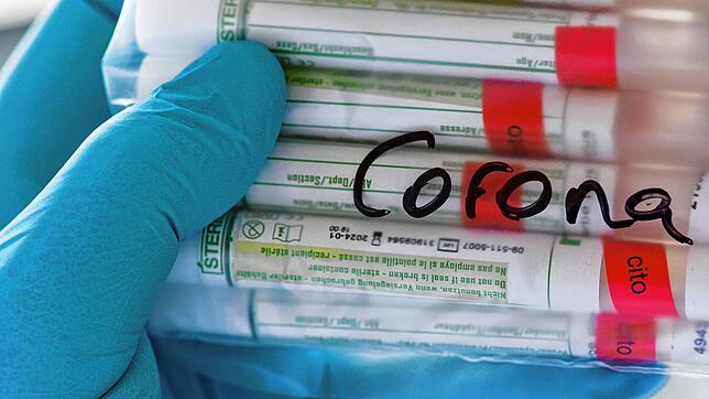 Proben für Corona-Tests im Labor. (Symbolbild)