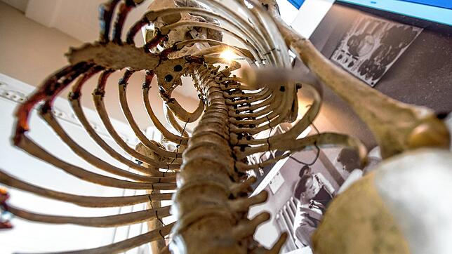 Blick auf die Wirbelsäule eines menschlichen Skeletts: An der Wirbelsäule finden viele neurochirurgische Eingriffe statt. Das Symbolbild ...