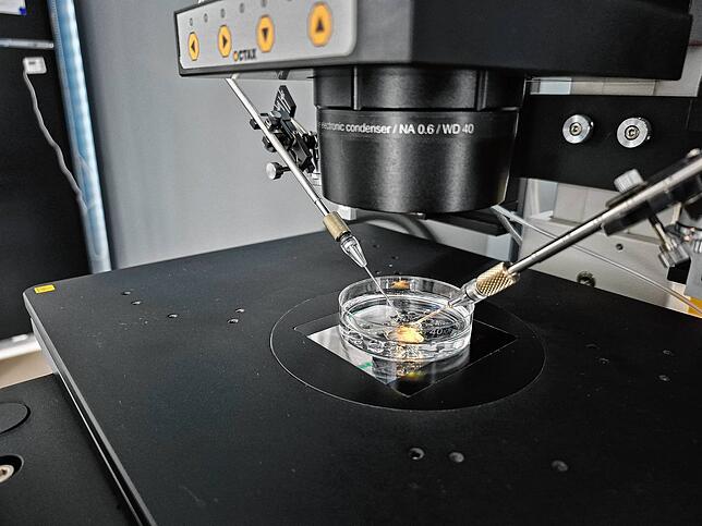 Unter einem speziellen Mikroskop kann bei dem ICSI-Verfahren mittels einer speziellen Glasnadel ein Spermium direkt in die Eizelle ...