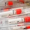 04.03.2020, Baden-Württemberg, Stuttgart: Röhrchen für einen Test auf das Virus SARS-CoV-2 liegen kurz bevor die Corona-Ambulanz des ...