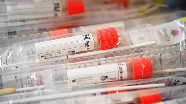 04.03.2020, Baden-Württemberg, Stuttgart: Röhrchen für einen Test auf das Virus SARS-CoV-2 liegen kurz bevor die Corona-Ambulanz des ...