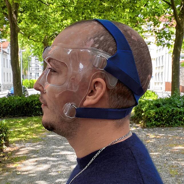 Robin Schellinger mit seiner Gesichtskompressionsmaske. Täglich muss er sie tragen, um seine Narben straffen zu können. Allein die ...