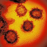 Eine elektronenmikroskopische Aufnahme des SARS-CoV2-Virus.