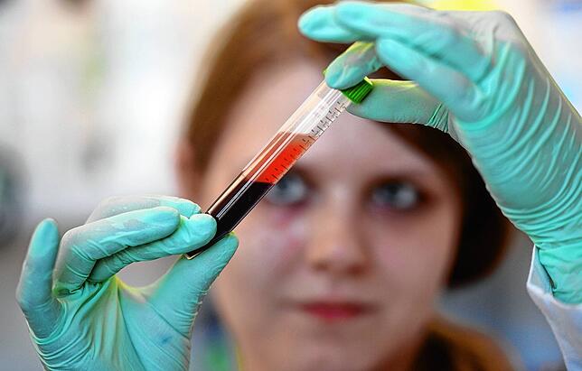Eine Medizinisch Technische Aisstentin überprüft die Blutprobe einer schwangeren Frau für einen Pränataltest.