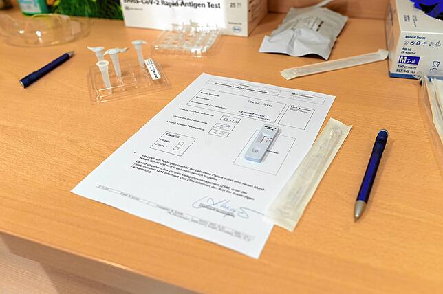 Jetzt heißt es Geduld: Erscheint in den nächsten 15 Minuten kein zweiter Strich, ist – im messbaren Bereich – alles in ...