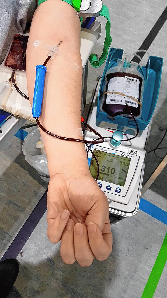 Redakteurin Ramona Löffler spendet selbst Blut – hier bei der Aktion in Stockach am 19. März.