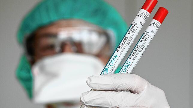Im Zollernalbkreis werden weitere Vorsichtsmaßnahmen getroffen, um die Ausbreitung des Virus zu verhindern.
