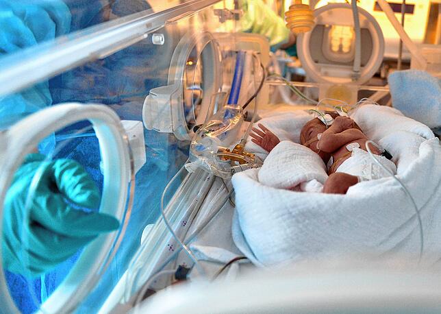 Ein zu früh geborenes Baby wird in einem Inkubator versorgt.