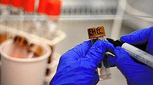 Eine Medizinisch-Technische Assistentin arbeitet unter einer Abzugshaube im Universitätsklinikum Hamburg-Eppendorf (UKE) an Stuhlproben, ...
