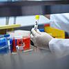 Weil Proben nicht mehr verwertbar sind, müssen Betroffene teilweise nochmals auf das Coronavirus getestet werden.