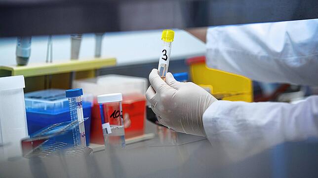 Weil Proben nicht mehr verwertbar sind, müssen Betroffene teilweise nochmals auf das Coronavirus getestet werden.