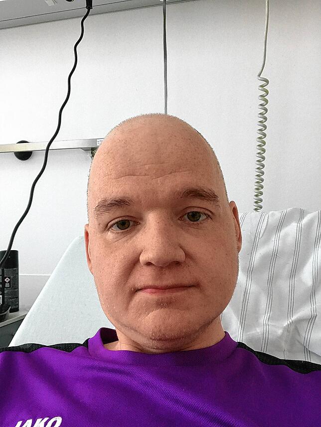 Markus Hilser im Juni 2020 während seiner Chemotherapie.