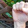 Symbolfoto: Nachbarschaftsstreit am Gartenzaun. Auch die Konstanzer Anwälte und Richter beschäftigt das Thema zunehmend. Die ...