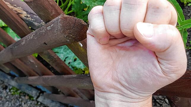 Symbolfoto: Nachbarschaftsstreit am Gartenzaun. Auch die Konstanzer Anwälte und Richter beschäftigt das Thema zunehmend. Die ...