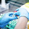 Eine Krankenschwester führt in einem spanischen Krankenhaus einen PCR-Test zur Erkennung des Affenpockenvirus durch.