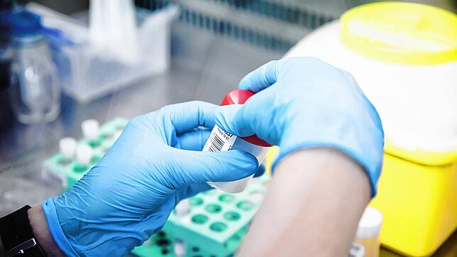 Eine Krankenschwester führt in einem spanischen Krankenhaus einen PCR-Test zur Erkennung des Affenpockenvirus durch.